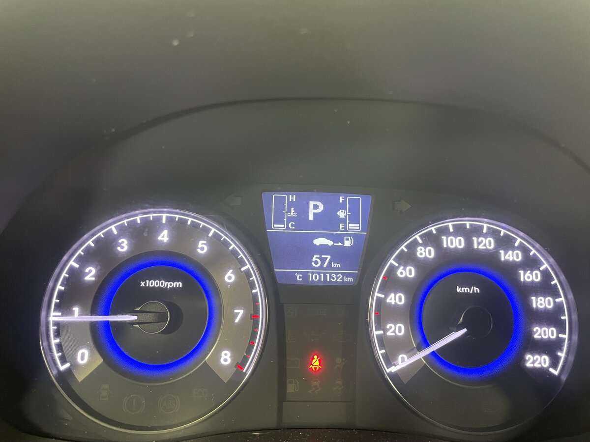 Б/У Хендай Солярис 2016 года. Фото: #11